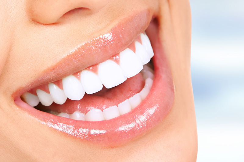 Cosmetic Dentistry in Slidell